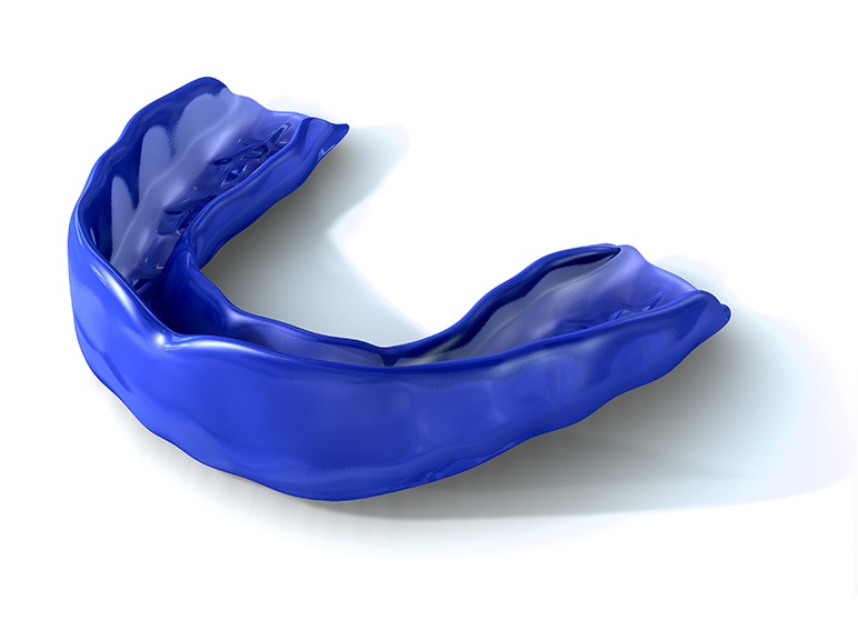 Sports Mouth Guards | Nuera Dental Center | General & Family Dentist | Downtown Calgary
